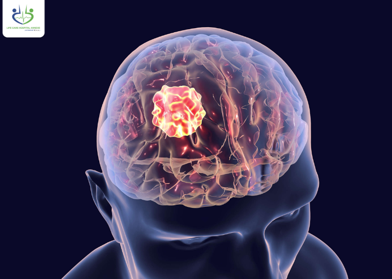 Brain Tumor Specialist in Thane